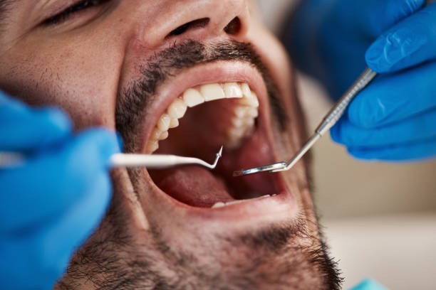 Best Urgent Tooth Repair  in Brandon, FL